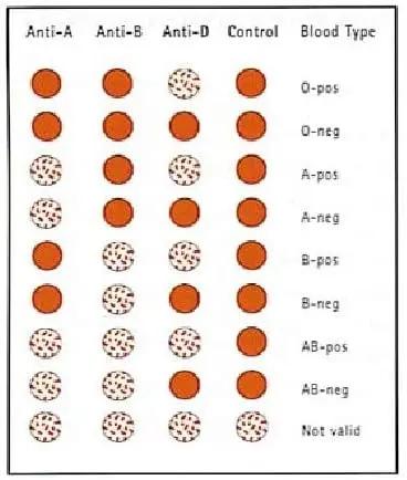 Eldoncard Blood Type Test Kit, Blood Typing Kit w/ Instructions Eldon