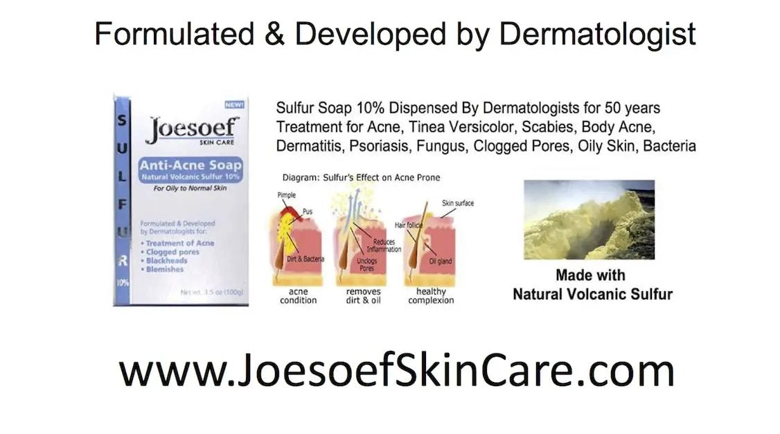 JOESOEF SKIN CARE Sulfur Soap for Acne Pharmaceutical Grade Dermatologists Approved for Acne Rosacea 100G JOESOEF SKIN CARE