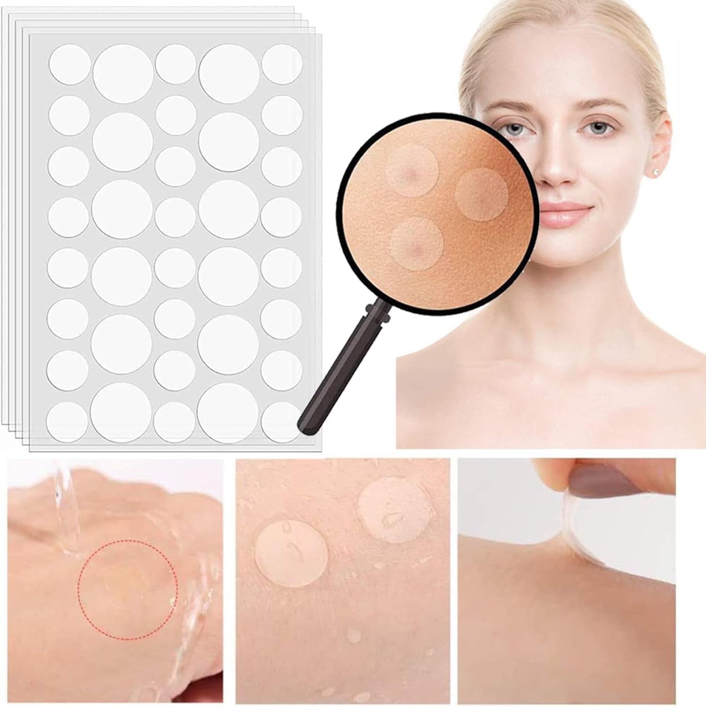 Rpanle Acne Patches, 180pcs Invisible Hydrocolloid Absorbing Pimple Patches, Acne Stickers Two Sizes, Blends in with Skin