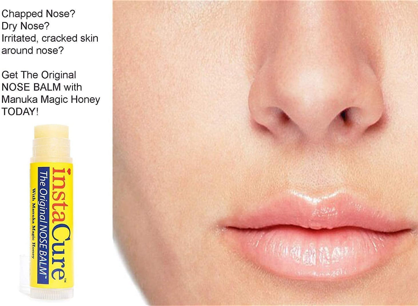 Fast Relief for Cracked, Dry and Sore Noses! InstaCure's Original Nose Balm with Raw Manuka Honey, Plus Coconut Oil, Shea Butter and Other Certified Organic Ingredients. Great Topical for Dogs' Noses!