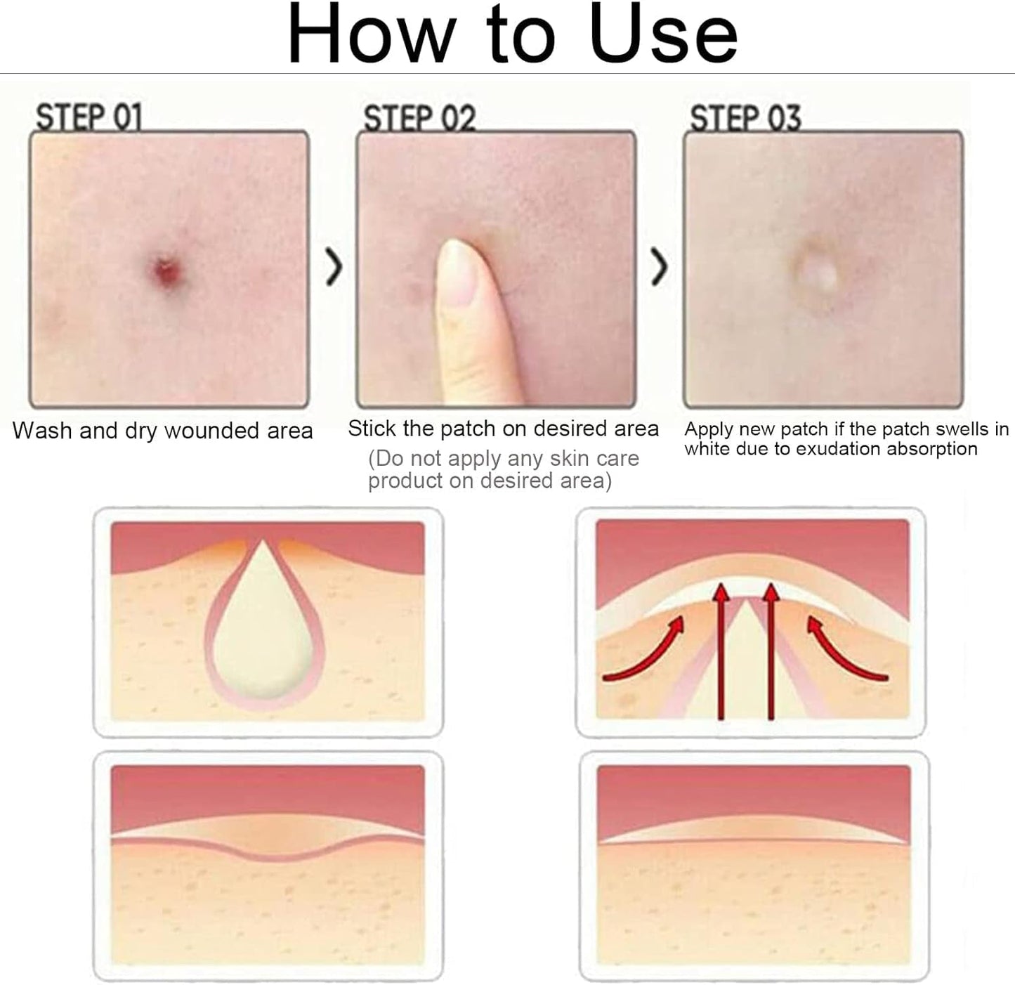 Rpanle Acne Patches, 180pcs Invisible Hydrocolloid Absorbing Pimple Patches, Acne Stickers Two Sizes, Blends in with Skin