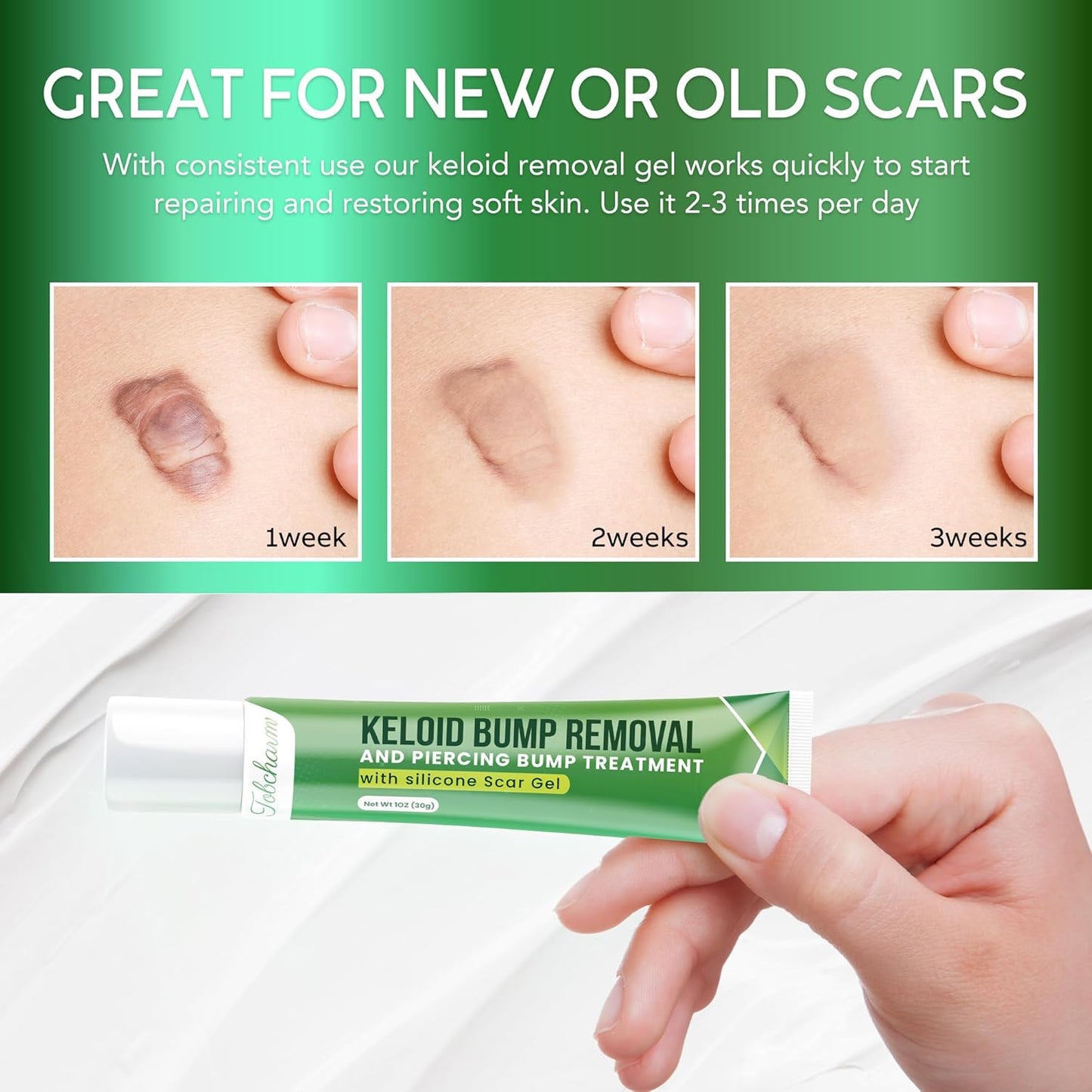Tobcharm Keloid Scar Removal, Keloid Bump Removal for Piercings like Nose, Ear Piercings Keloid, also works for Stretch Marks, Surgical Scars, Great Piercing Bump Treatment with 30g Silicone Gel
