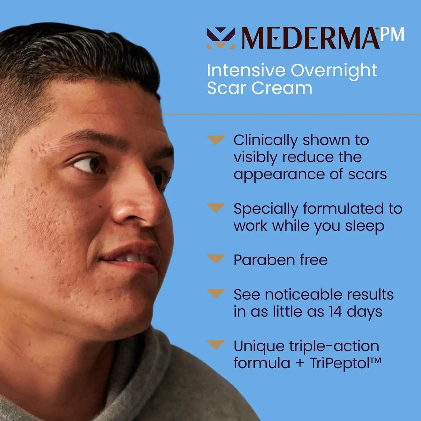 Mederma PM Intensive Overnight Scar Cream - 1.0 oz (28g) Advanced Scar Treatment that Works with Skin's Nighttime Regenerative Activity Vitamins Depots