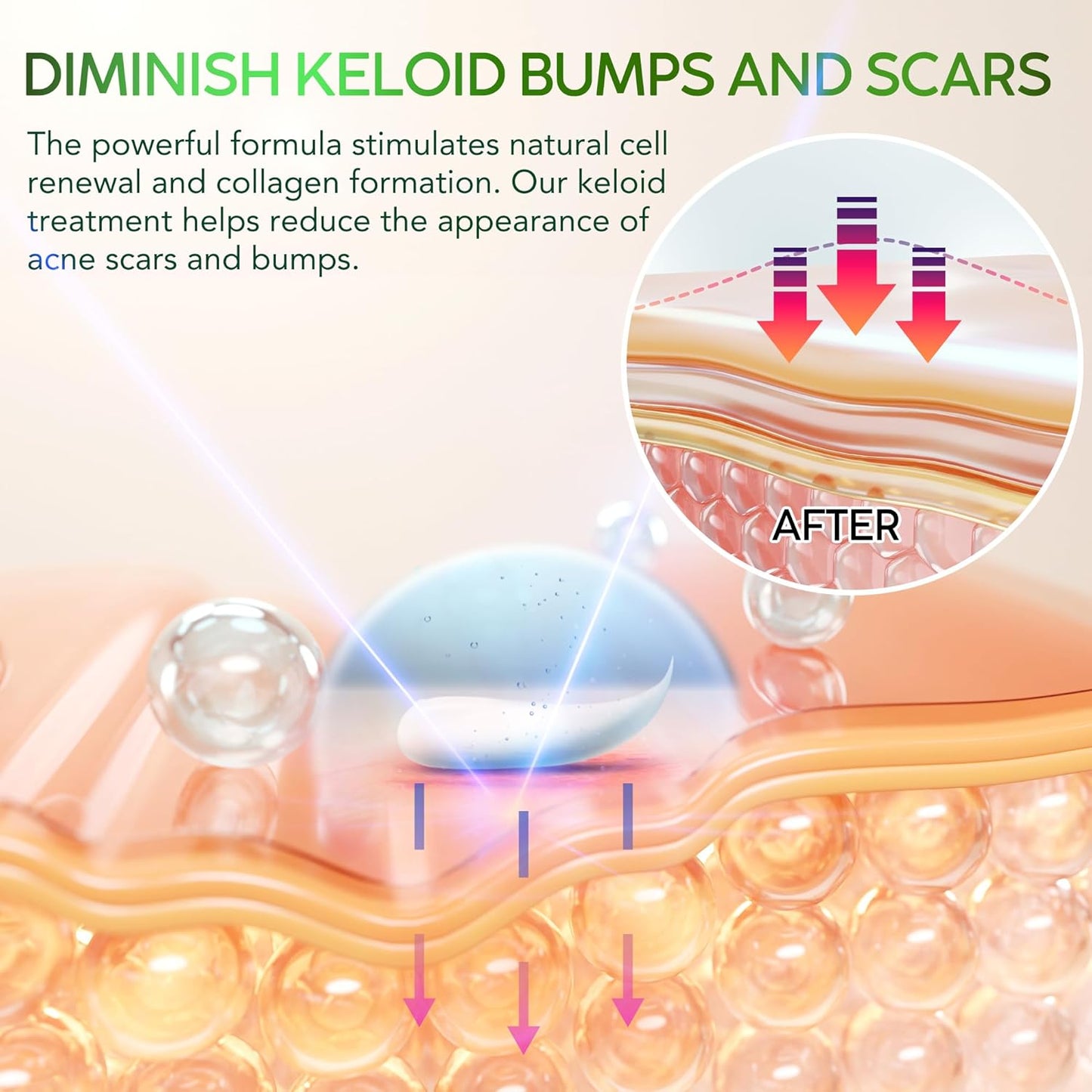 Tobcharm Keloid Scar Removal, Keloid Bump Removal for Piercings like Nose, Ear Piercings Keloid, also works for Stretch Marks, Surgical Scars, Great Piercing Bump Treatment with 30g Silicone Gel