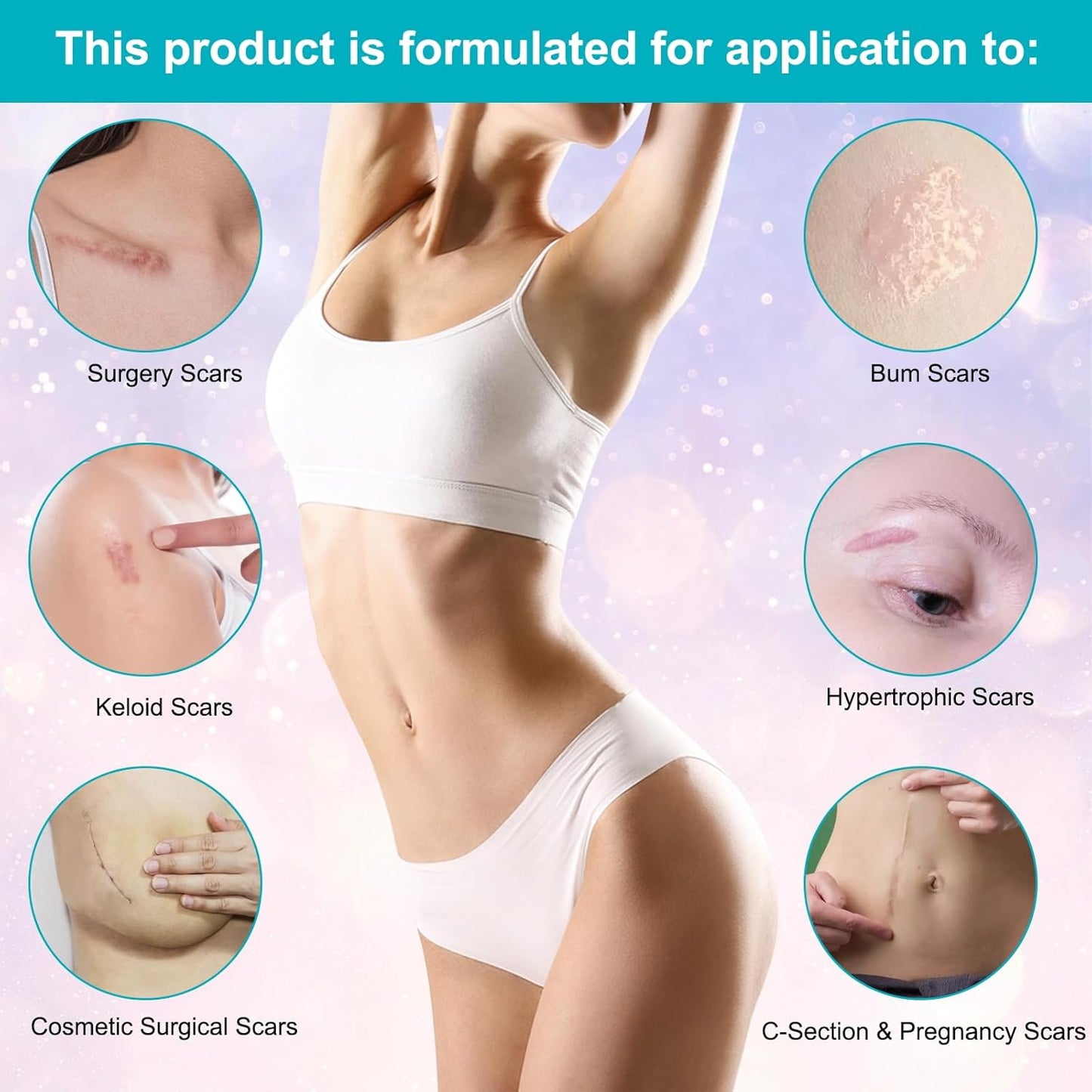 Kelinul Advanced Scar Cream - Silicone Scar Gel for Scars - Medical Grade Silicone Scar Removal Crean for C-Section & Keloid Surgery, Burn, Acne, Tummy Tuck - 1.7 oz