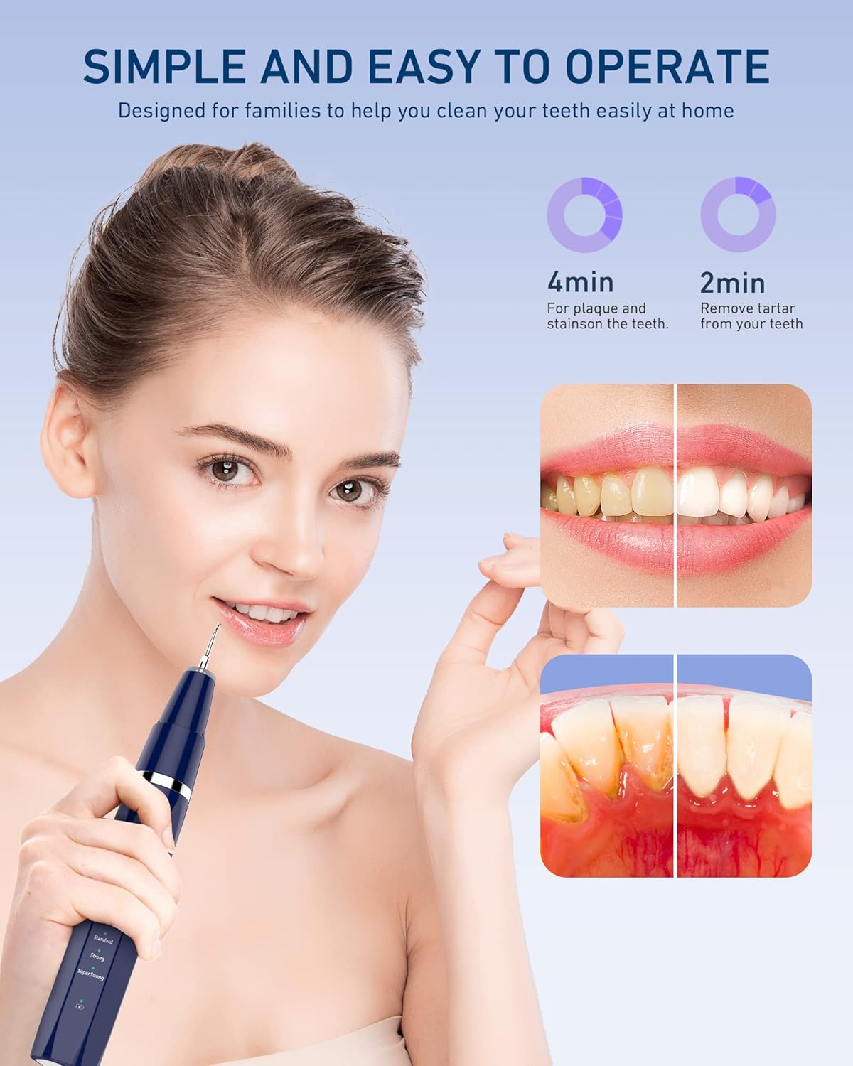 Plaque Remover for Teeth, Tartar Remover for Teeth with 5 Adjustable Modes & 2 Replaceable Heads, Electric Teeth Cleaner Kit with Dental Tools & Tongue Cleaner, Dental Calculus Remover with LED Light