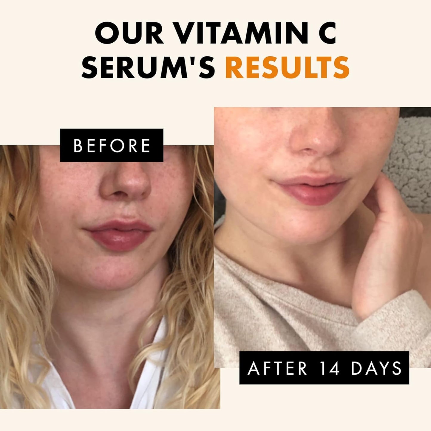 Eclat Vitamin C Face Serum - Hyaluronic Acid, Retinol, & Vit E - Anti Aging Facial Brightening Serum for Skin Care - Timeless Pure Vitamin C Serum for Face Dark Spots, Vit C Serum Oil, Face Serum for Women