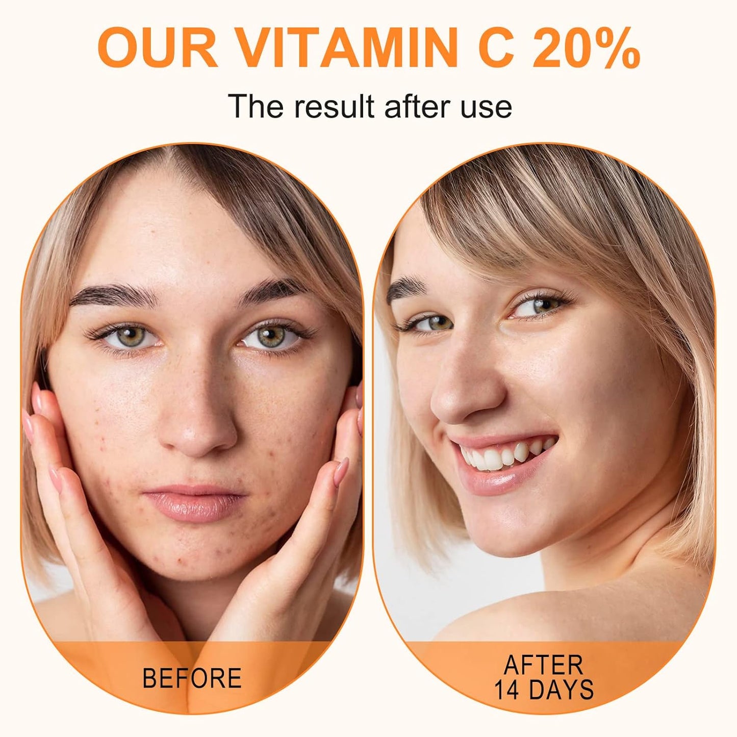 PREMIUM Vitamin C Serum For Face with Hyaluronic Acid Serum - Anti Ageing & Anti Wrinkle Serum