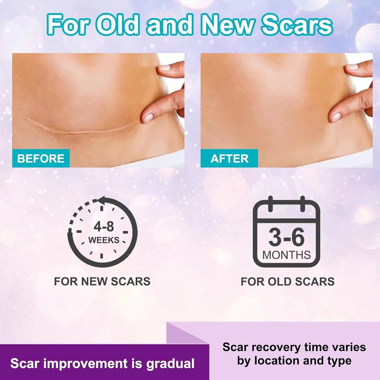 Kelinul Advanced Scar Cream - Silicone Scar Gel for Scars - Medical Grade Silicone Scar Removal Crean for C-Section & Keloid Surgery, Burn, Acne, Tummy Tuck - 1.7 oz Kelinul