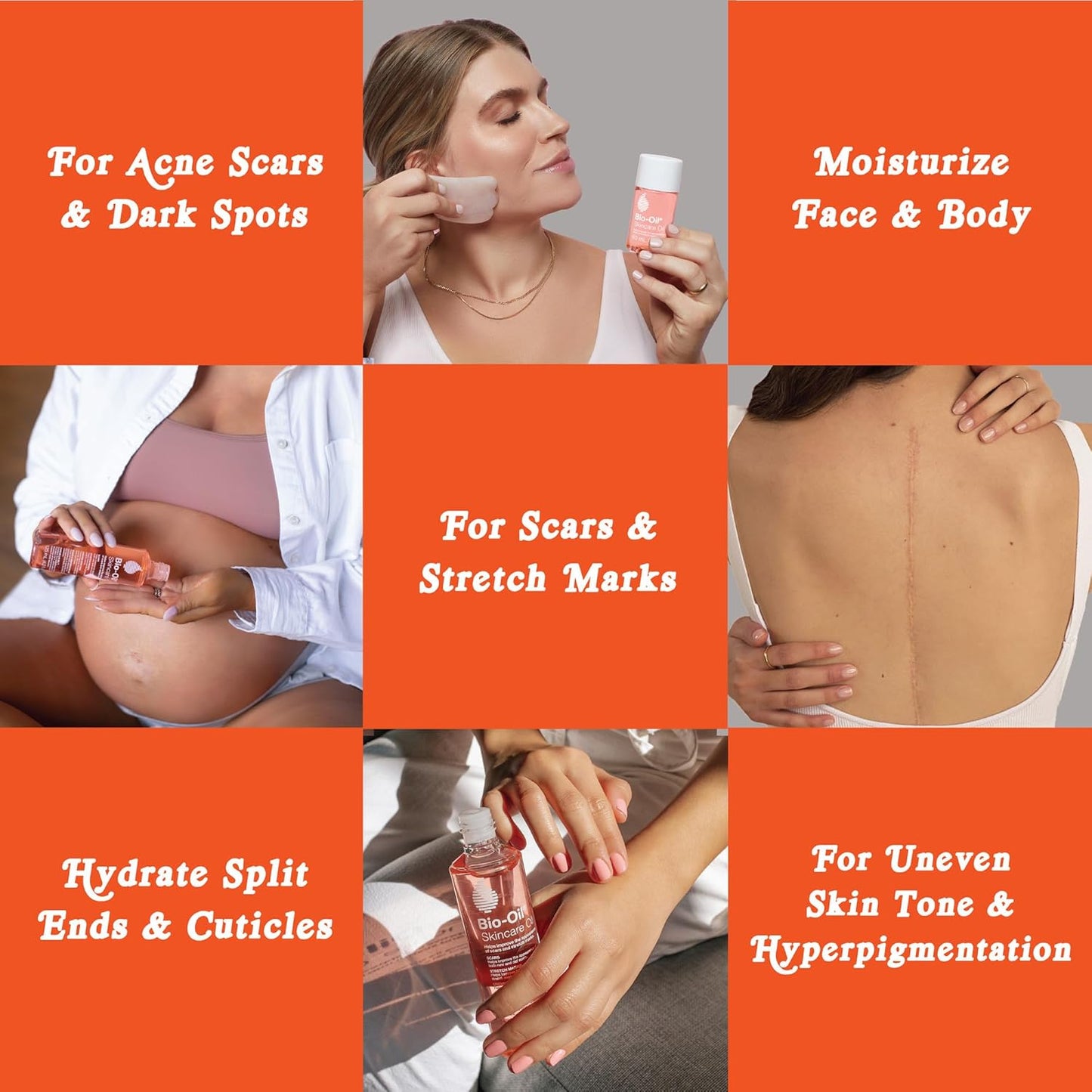 Bio-Oil Skincare Oil with Vitamin E, Serum for Scars and Stretchmarks, Face and Body Moisturizer for Sensitive Dry Skin