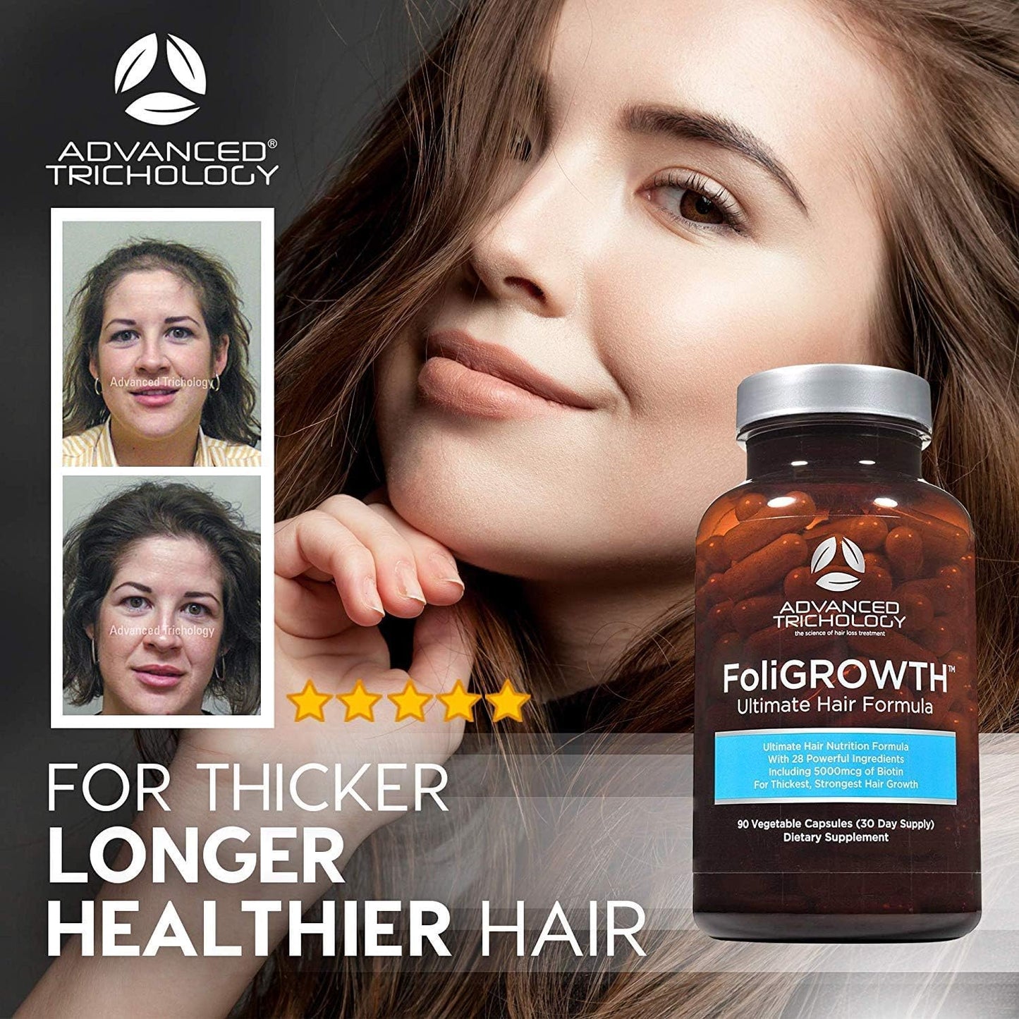FoliGROWTH Growth Supplement for Thicker Fuller Hair