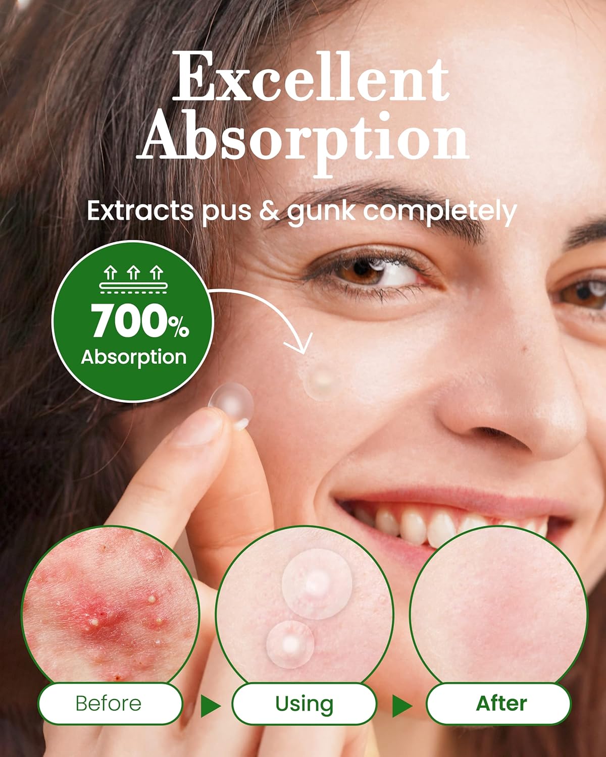 Troubless Invisible Pimple Spot Patch - Signature, Hydrocolloid Acne Patches for Face | Ultra Thin Acne Patches with Easy Peel Handle | Overnight Pimple Patches | Overnight Zitsticka | 2 Sizes, 96 Cou