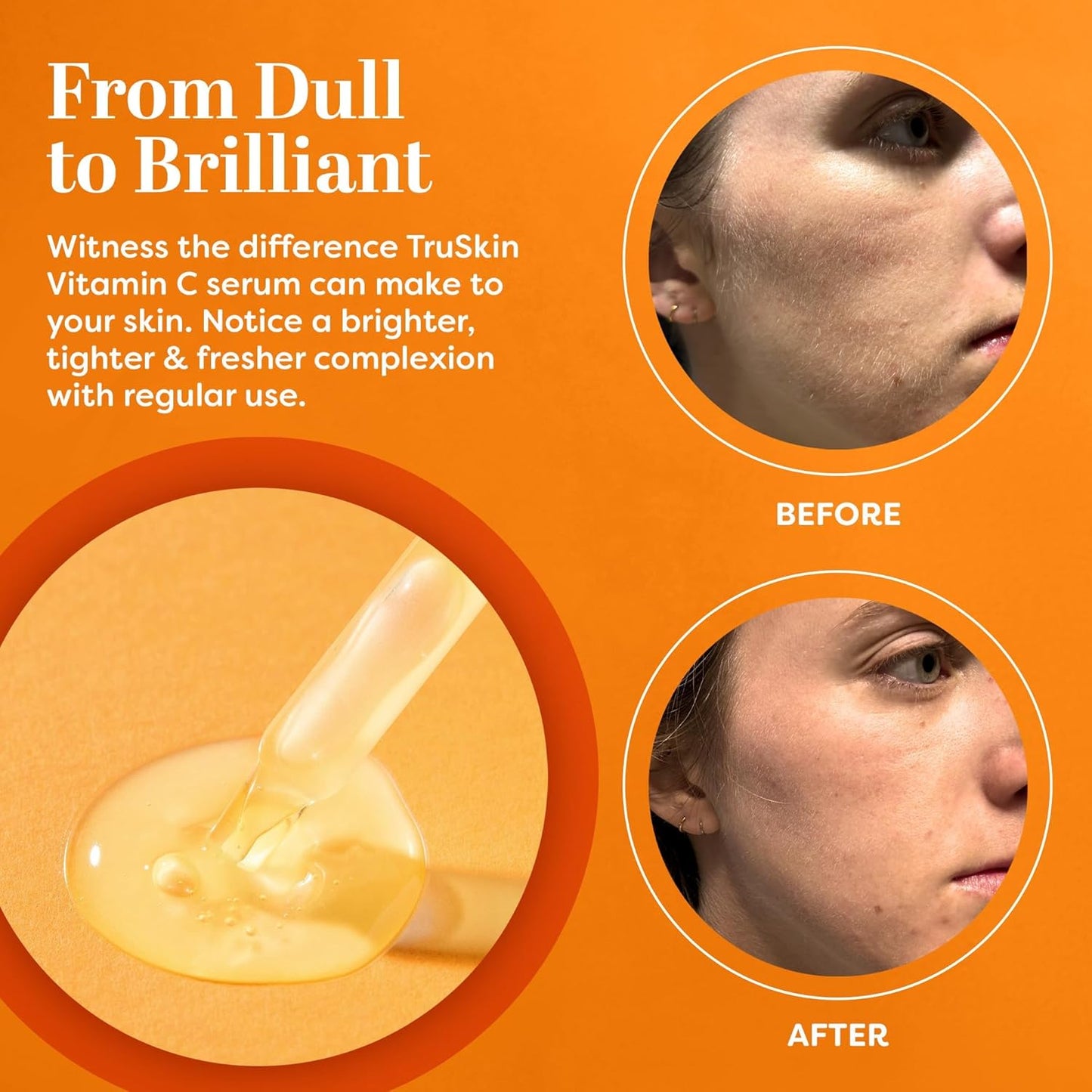 TruSkin Vitamin C Serum for Face – Anti Aging Face Serum with Vitamin C, Hyaluronic Acid, Vitamin E – Brightening Serum for Dark Spots, Even Skin Tone, Eye Area, Fine Lines & Wrinkles, 1 Fl Oz