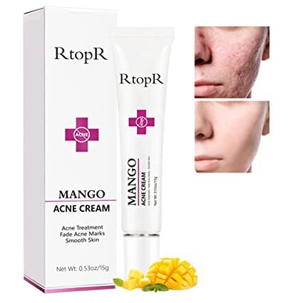 Easilydays Mango Repair Acne Cream, Face Pimple Removal Cream Acne Scar Treatment, Moisturize Skin, Fade Pockmarks Gently and Shrink Pores, for Acne Scar Removal, Spots, Balanced Water and Oil