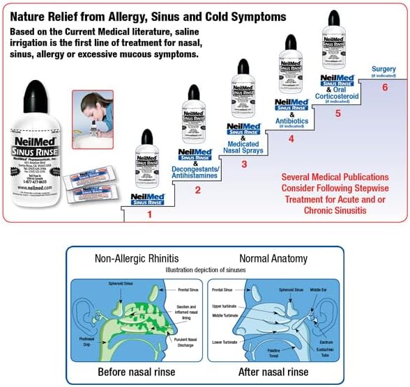 NeilMed Sinus Rinse - A Complete Sinus Nasal Rinse Kit, 50 count