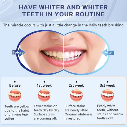 Maycharm Teeth Whitening Strips, Reduced Sensitive White Strips, Enamel Safe Teeth Whitening Strips, Whitening Without The Harm (14 Strips (7 Count Pack))