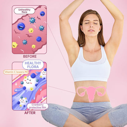 Anytalk Vaginal Probiotics for Women - 90 capsules