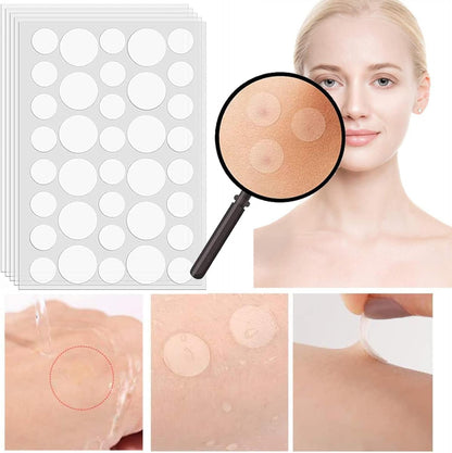 Rpanle Acne Patches, 180pcs Invisible Hydrocolloid Absorbing Pimple Patches, Acne Stickers Two Sizes, Blends in with Skin