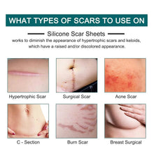 Silicone Scar Sheets (1.6” x 120” Roll-3M), Silicone Scar Tape Roll, Scar Silicone Strips, Reusable, Professional Scar Removal Sheets for C-Section, Surgery, Burn, Keloid, Acne et Vitamins Depots