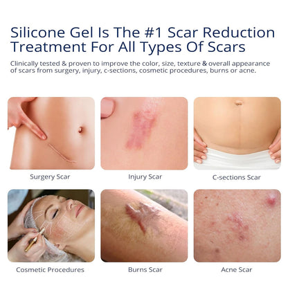 Scar Cream Gel, Silicone Scar Gel for C-Section, Stretch Marks, Acne, Surgery, Surgical Effective Treatment, Old and New Scars Management - 30g