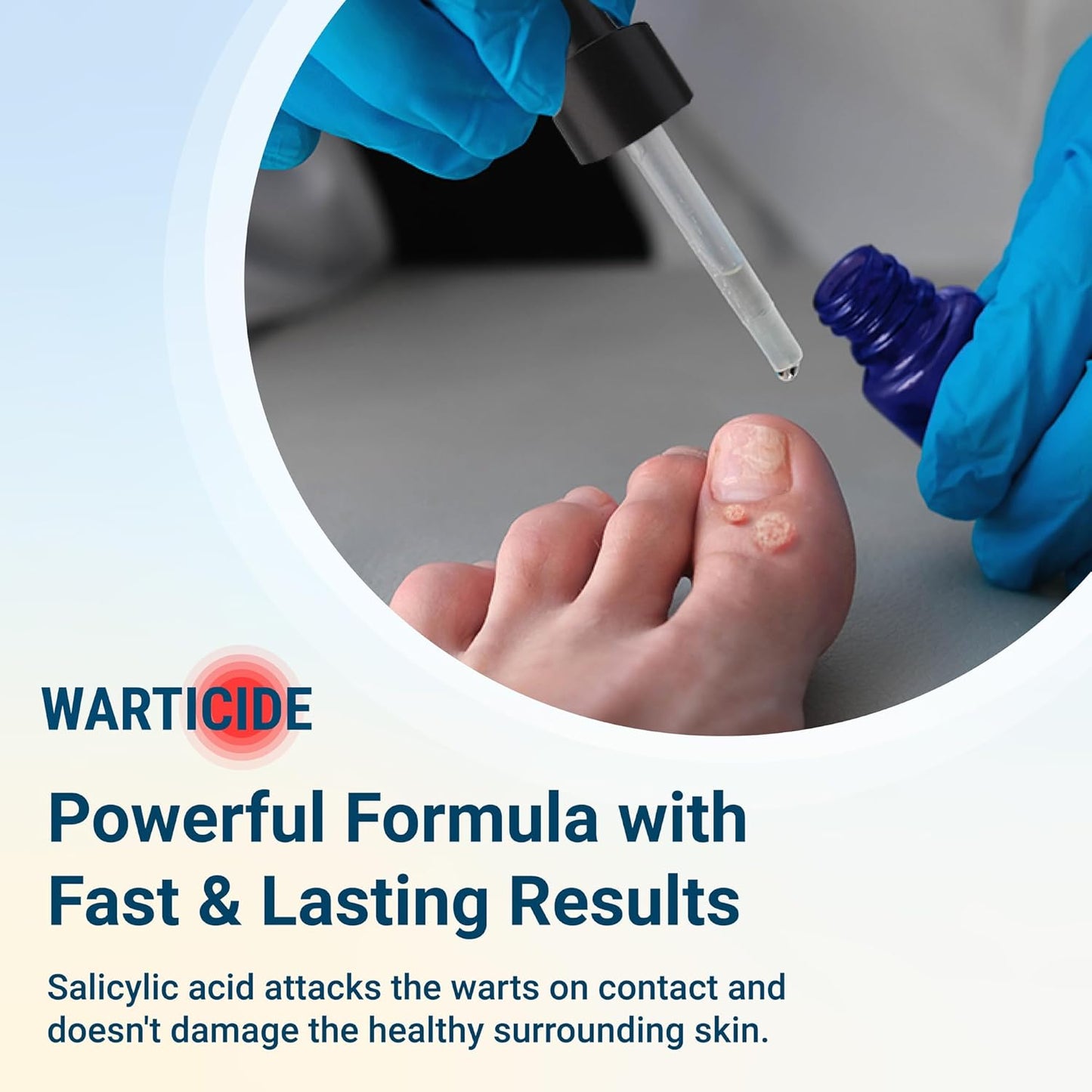 Warticide Fast-Acting Wart Remover - Plantar and Genital Wart Treatment, Attacks Warts On Contact, Easy Application (1 Fluid Ounce)