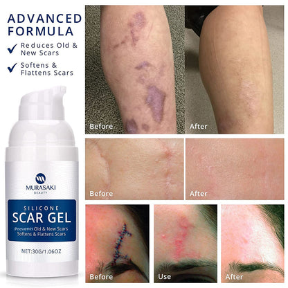 Scar Cream Gel, Silicone Scar Gel for C-Section, Stretch Marks, Acne, Surgery, Surgical Effective Treatment, Old and New Scars Management - 30g