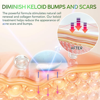 Tobcharm Keloid Scar Removal, Keloid Bump Removal for Piercings like Nose, Ear Piercings Keloid, also works for Stretch Marks, Surgical Scars, Great Piercing Bump Treatment with 30g Silicone Gel