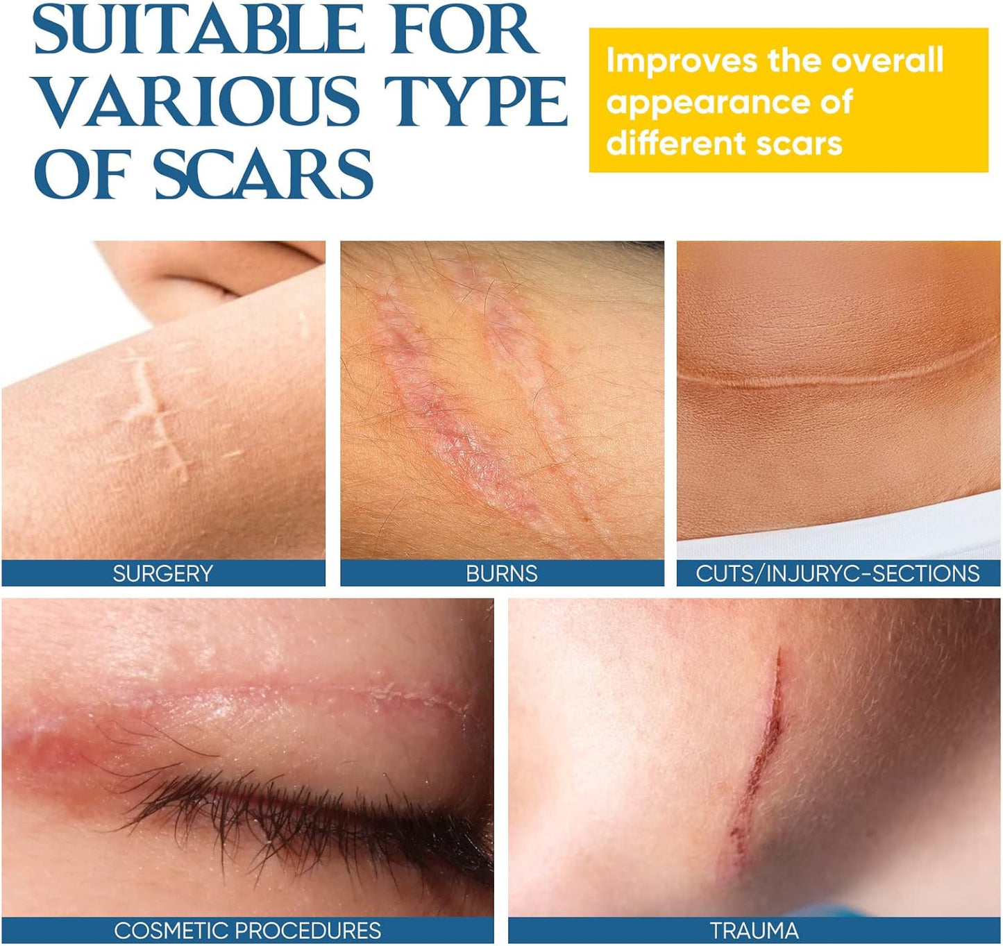 Keloid Bump Removal, Keloid Scar Treatment for Nose & Ear & Belly Piercings, Advanced Silicone Scar Gel for Stretch Mark, Burn Scar, Surgical Scar, C-Section Scar, Old & New Scars