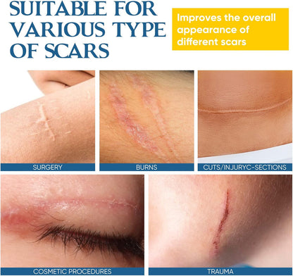 Keloid Bump Removal, Keloid Scar Treatment for Nose & Ear & Belly Piercings, Advanced Silicone Scar Gel for Stretch Mark, Burn Scar, Surgical Scar, C-Section Scar, Old & New Scars