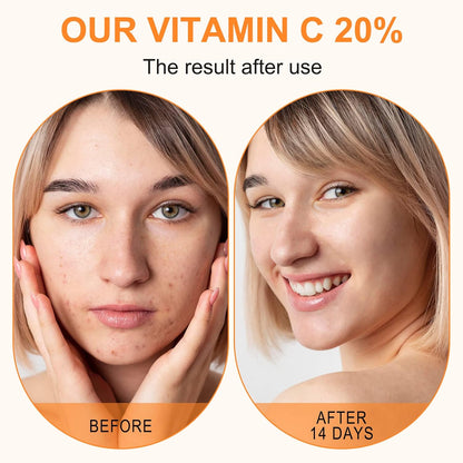 PREMIUM Vitamin C Serum For Face with Hyaluronic Acid Serum - Anti Ageing & Anti Wrinkle Serum