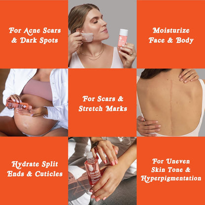 Bio-Oil Skincare Oil with Vitamin E, Serum for Scars and Stretchmarks, Face and Body Moisturizer for Sensitive Dry Skin