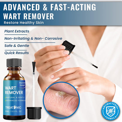 Treatonic Wart Remover, Wart Remover Freeze Off, Wart Removal, Fast Acting Gel Wart Remover, Plantar Wart Remover for Feet, Suitable for All Skin Types