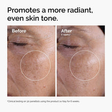 The Ordinary Glycolic Acid 7% Exfoliating Toner, Brightening and Smoothing Daily Toner for More Even-Looking Skin Tone The ordinary