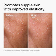 The Ordinary Hyaluronic Acid 2% + B5, Multi-Depth Hydration Serum for Plumper, Smoother Skin The ordinary