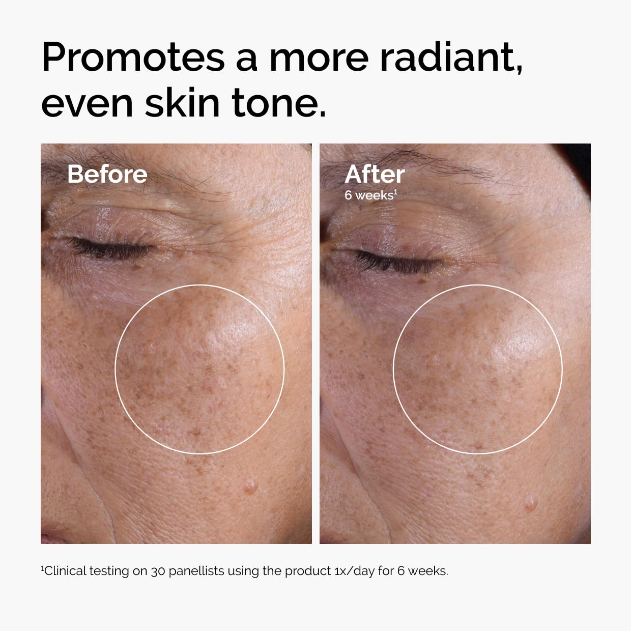 The Ordinary Glycolic Acid 7% Exfoliating Toner, 100ml, Brightening and Smoothing Daily Toner for More Even-Looking Skin Tone